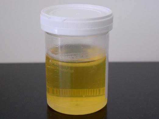 Est-il possible de boire de l'urine?