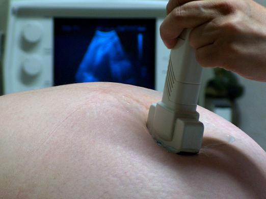 À quelle fréquence pouvez-vous faire des ultrasons?