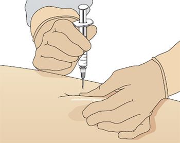 Comment faire une injection?