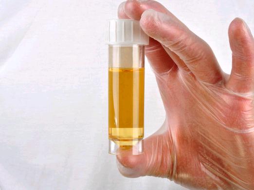 Pourquoi l'urine sent-elle?